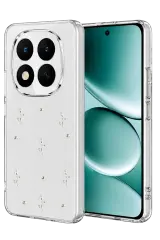 Newface Xiaomi Redmi Note 15 Pro 5g Fiyonk Desenli Kapak - Desen 4