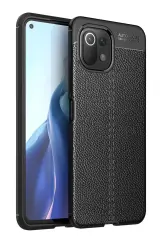 Newface Xiaomi Mi 11 Lite Kılıf Auto Focus Kapak - Siyah