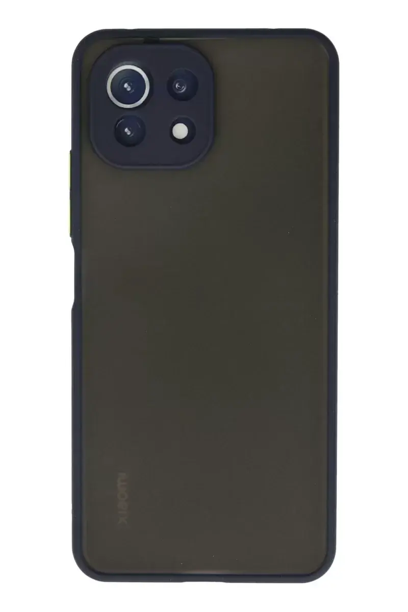 Newface Xiaomi Mi 11 Lite Kılıf Montreal Silikon Kapak - Lacivert