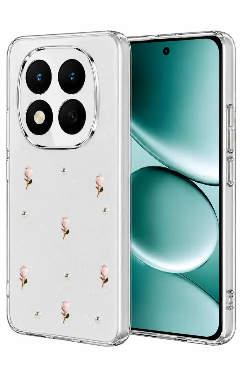 Newface Xiaomi Redmi Note 15 Pro 5g Fiyonk Desenli Kapak - Desen 6