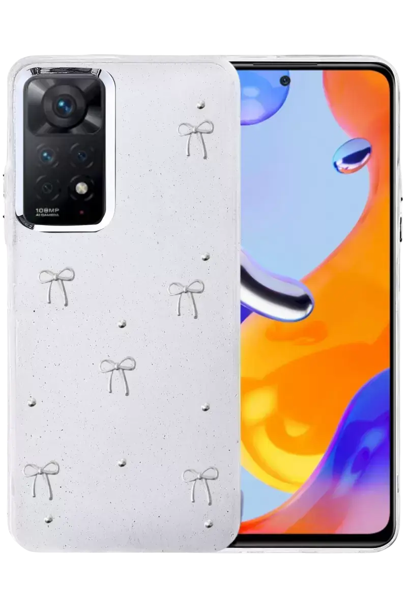 Newface Xiaomi Redmi Note 11 Pro Fiyonk Desenli Kapak - Desen 5