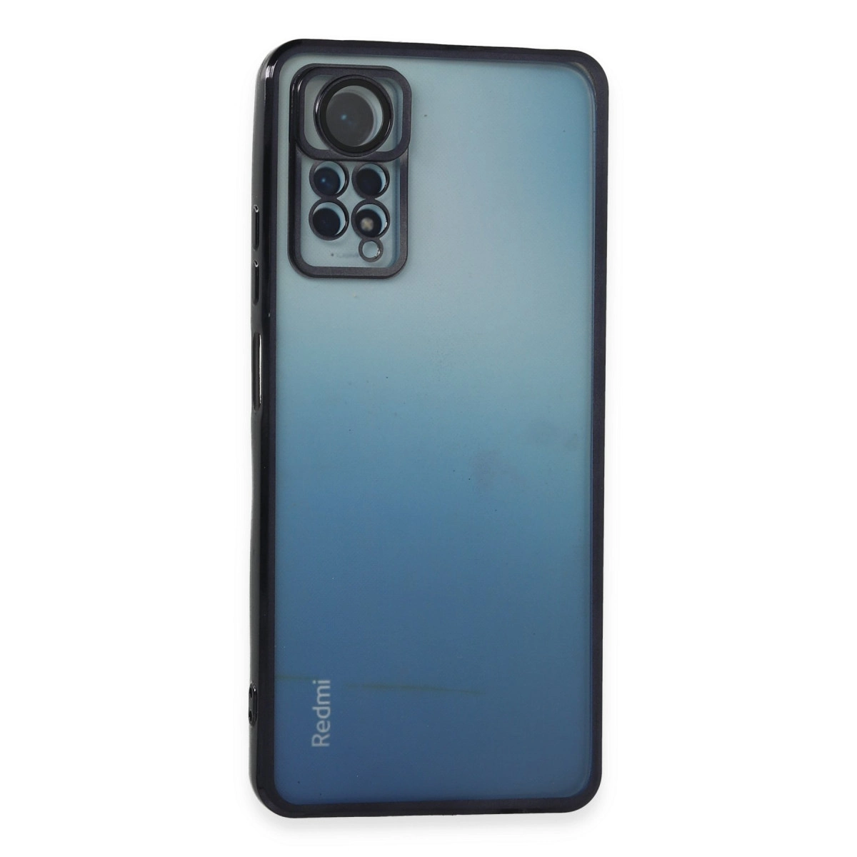 Xiaomi Redmi Note 11 Pro Kılıf Razer Lensli Silikon - Siyah
