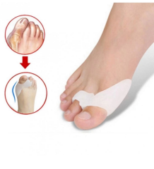 Baş Parmak Bunyon Silikonu Parmak Arası Destek Medikal Silikon  Ağrı Azaltmaya Yardımcı