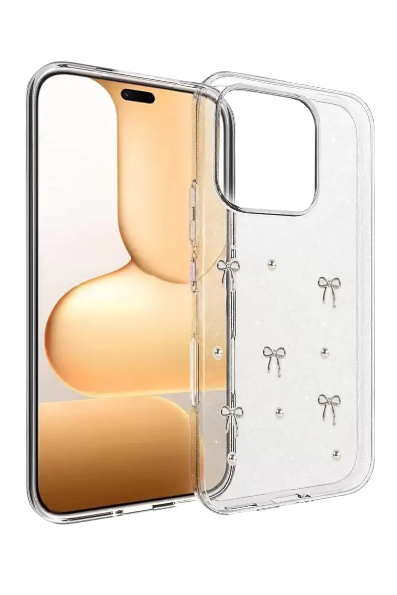 Newface Huawei Honor 600 Lite Fiyonk Desenli Kapak - Desen 5