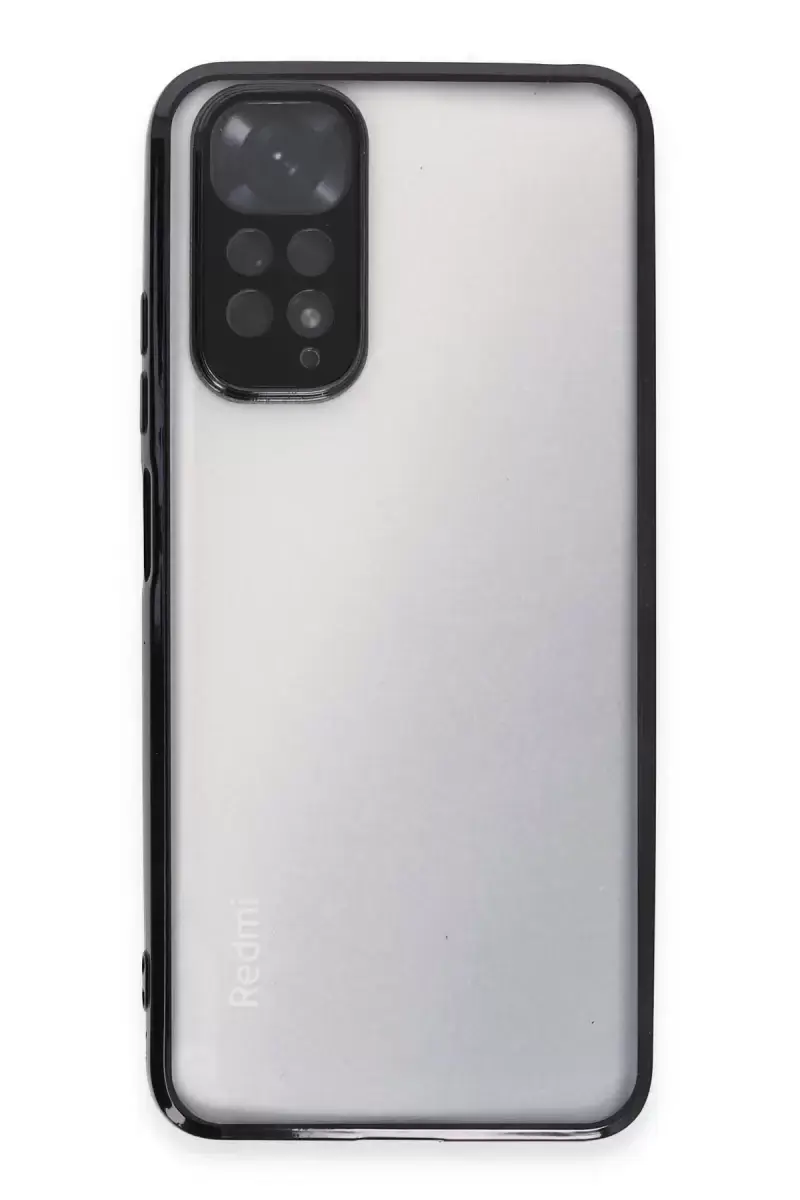 Newface Xiaomi Redmi Note 11 Kılıf Razer Lensli Silikon - Siyah