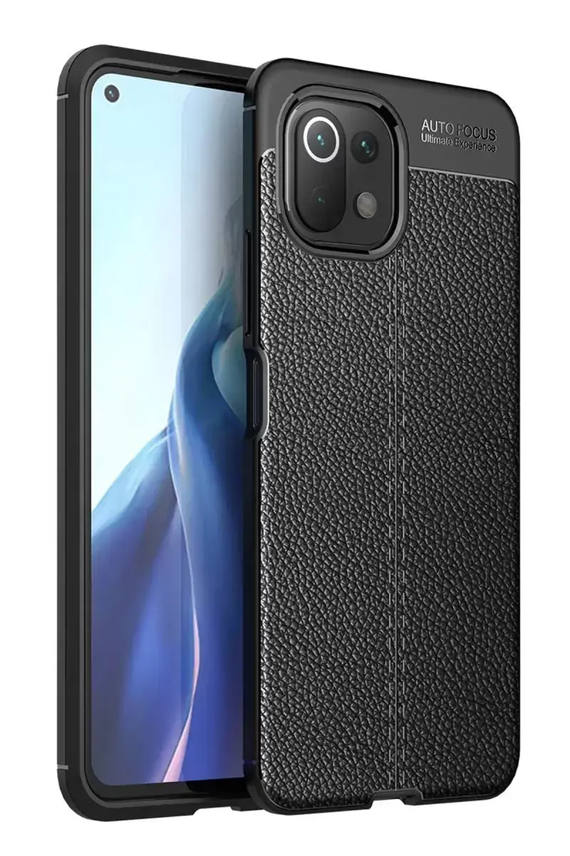 Newface Xiaomi Mi 11 Lite Kılıf Auto Focus Kapak - Siyah