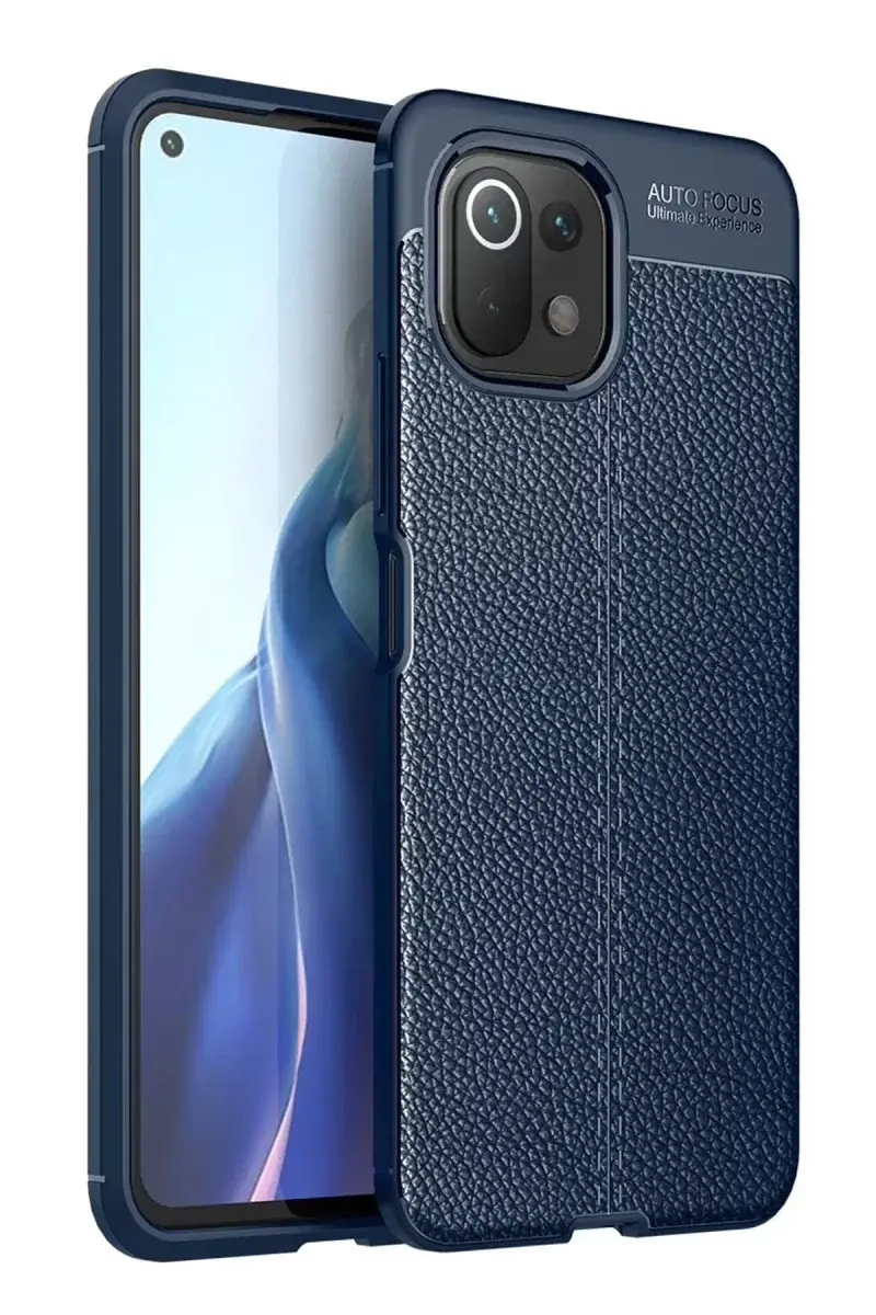 Newface Xiaomi Mi 11 Lite Kılıf Auto Focus Kapak - Lacivert