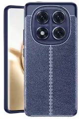 Newface Xiaomi Redmi Note 14 Pro 4g Kılıf Auto Focus Kapak - Lacivert