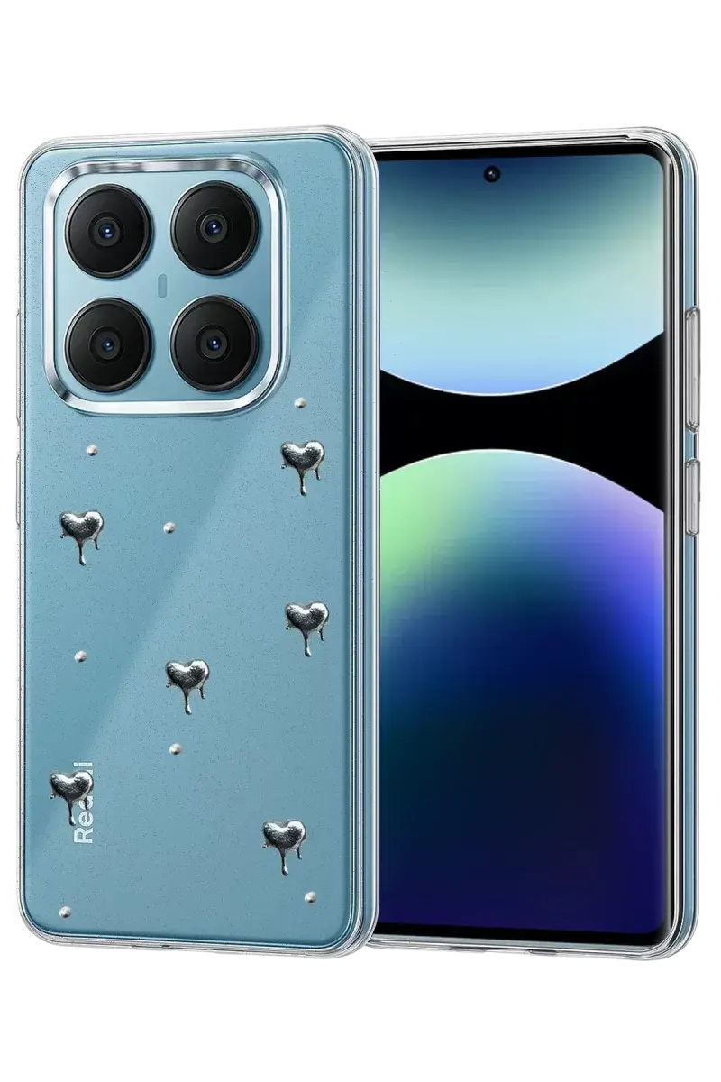 Newface Xiaomi Redmi Note 14 Pro 4g Fiyonk Desenli Kapak - Desen 1