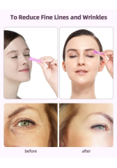 Hacamat Kupası Seti Silikon - 5li Set - Selülit Masaj Seti