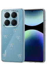 Newface Xiaomi Redmi Note 14 Pro 4g Fiyonk Desenli Kapak - Desen 5