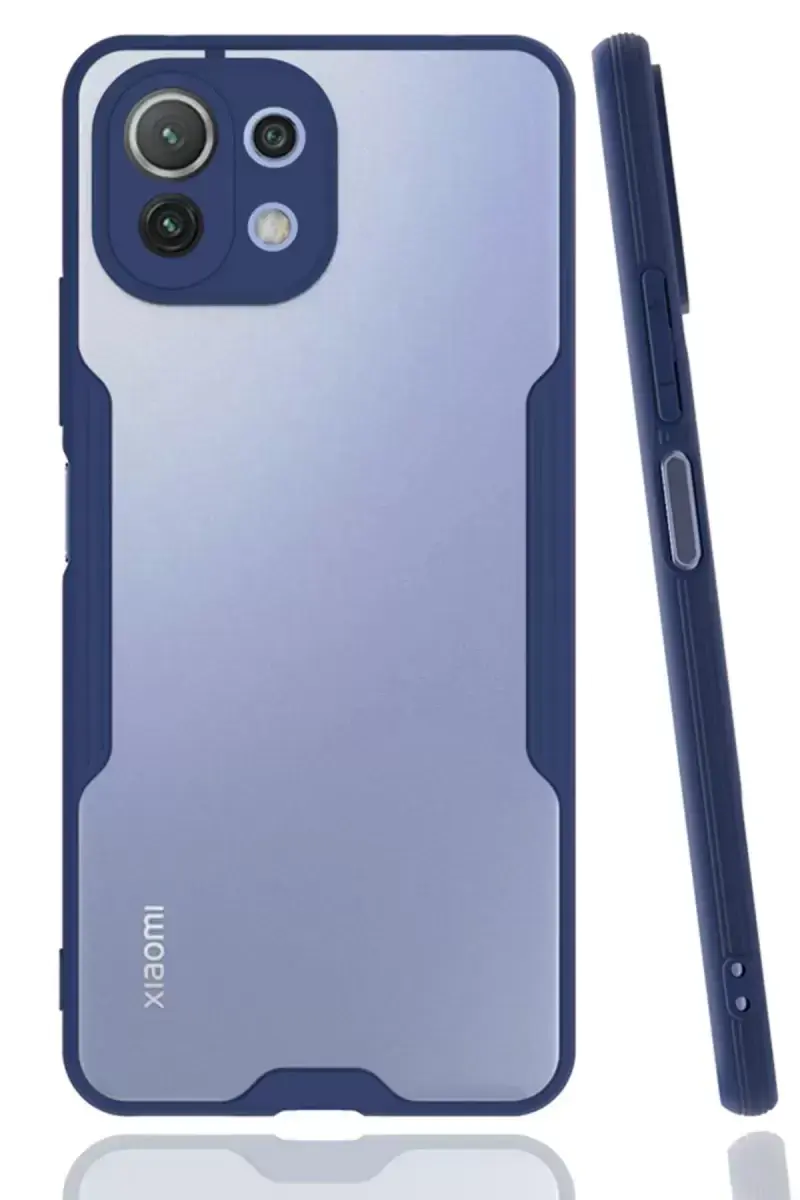Newface Xiaomi Mi 11 Lite Kılıf Platin Silikon - Lacivert
