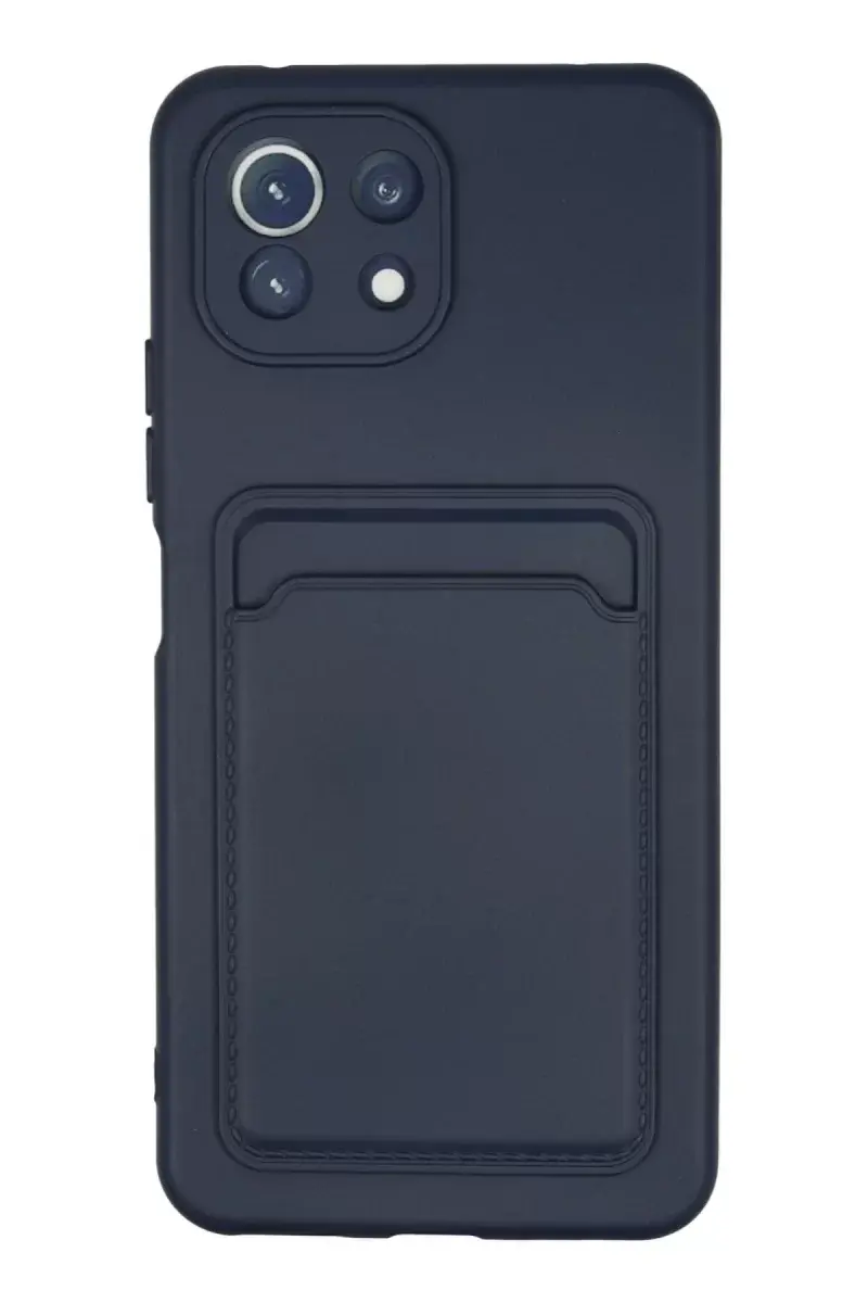 Newface Xiaomi Mi 11 Kılıf Kelvin Kartvizitli Silikon - Lacivert