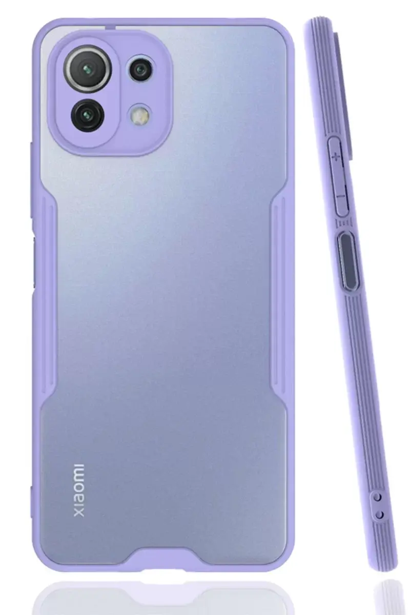 Newface Xiaomi Mi 11 Lite Kılıf Platin Silikon - Lila