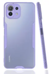 Newface Xiaomi Mi 11 Lite Kılıf Platin Silikon - Lila