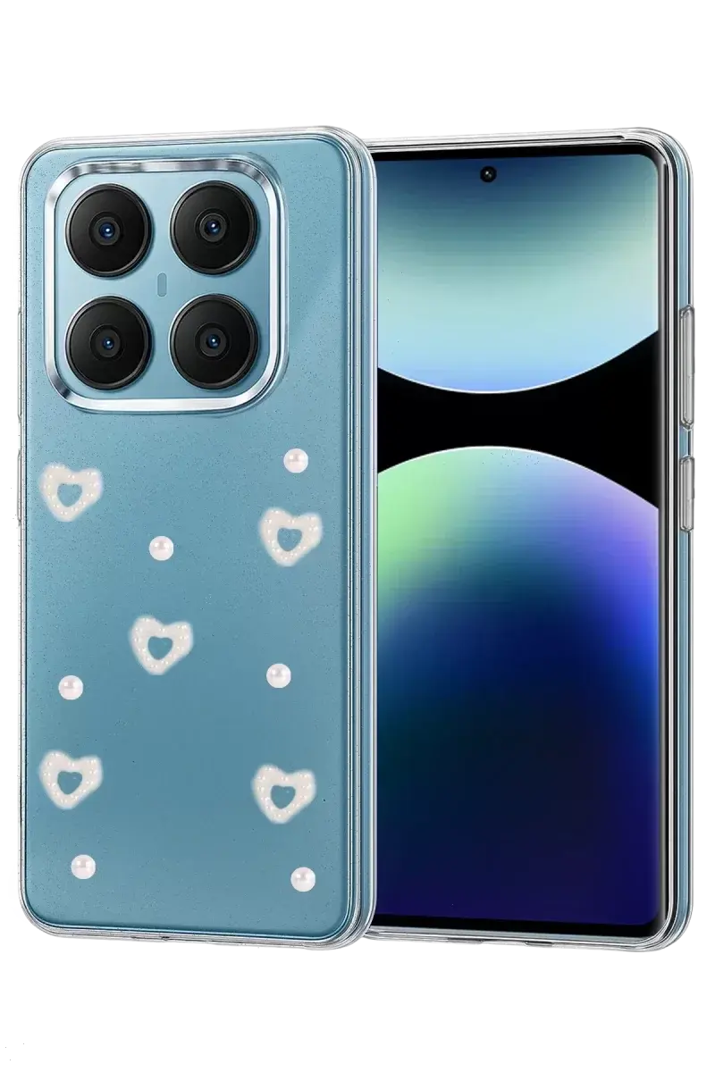 Newface Xiaomi Redmi Note 14 Pro 4g Fiyonk Desenli Kapak - Desen 10