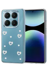 Newface Xiaomi Redmi Note 14 Pro 4g Fiyonk Desenli Kapak - Desen 10