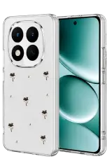 Newface Xiaomi Redmi Note 15 Pro 5g Fiyonk Desenli Kapak - Desen 1