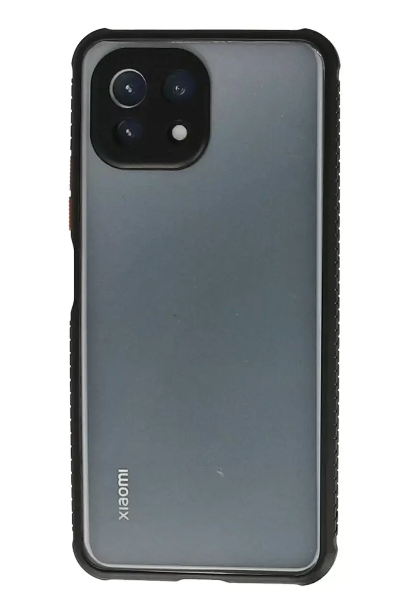 Newface Xiaomi Mi 11 Lite Kılıf Miami Şeffaf Silikon - Siyah