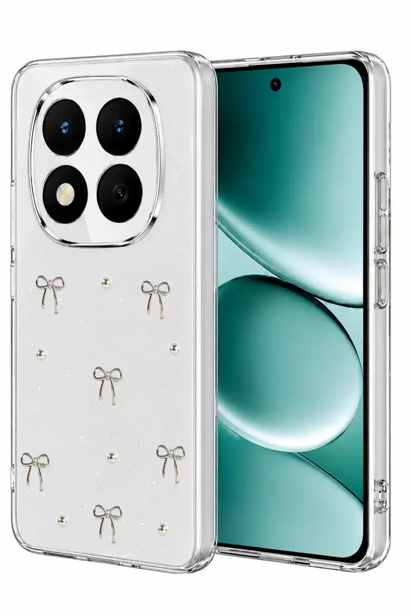 Newface Xiaomi Redmi Note 15 Pro 5g Fiyonk Desenli Kapak - Desen 5