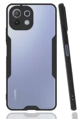 Newface Xiaomi Mi 11 Lite Kılıf Platin Silikon - Siyah