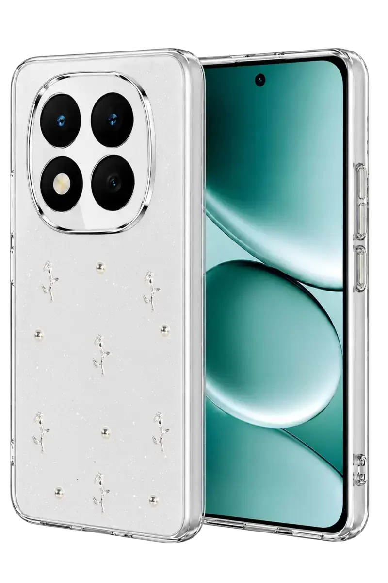 Newface Xiaomi Redmi Note 15 Pro 4g Fiyonk Desenli Kapak - Desen 4