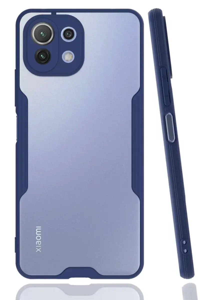 Newface Xiaomi Mi 11 Lite Kılıf Platin Silikon - Lacivert