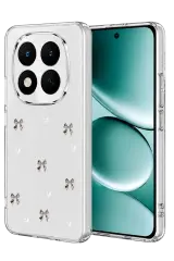 Newface Xiaomi Redmi Note 15 Pro Plus 5g Fiyonk Desenli Kapak - Desen 8